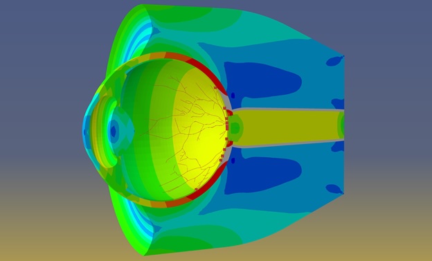 Researchers Design Simulation to Better Understand Newborn Retinal Hemorrhaging